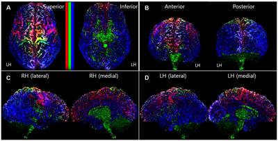 Track-Density Ratio Mapping With Fiber Types in the Cerebral Cortex Using Diffusion-Weighted MRI